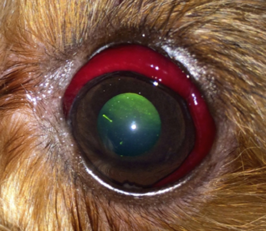 Рис.1. Контузия глазного яблока легкой степени. Конъюнктивальная гематома.