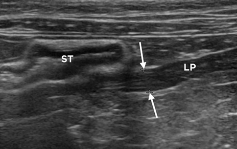 РИСУНОК 5. Поперечный ультразвуковой скан левого эпигастрия кошки каудальнее желудка (ST)