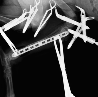 Рис.8. Интраоперационная рентгенограмма. Достигнута удовлетворительная репозиция костных отломков.