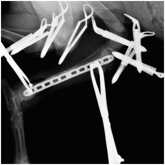Рис.6. Интраоперационная рентгенограмма. Достигнута удовлетворительная репозиция костных отломков.