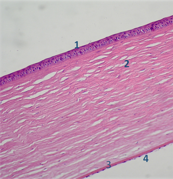 Рис 1. Микрокартина роговицы глаза в норме: 1 – поверхностный эпителий; 2 – строма роговицы; 3 – десцеметова мембрана; 4 – внутренний эпителий (эндотелий).