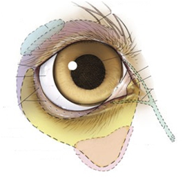 Ультразвуковое исследование глазного яблока