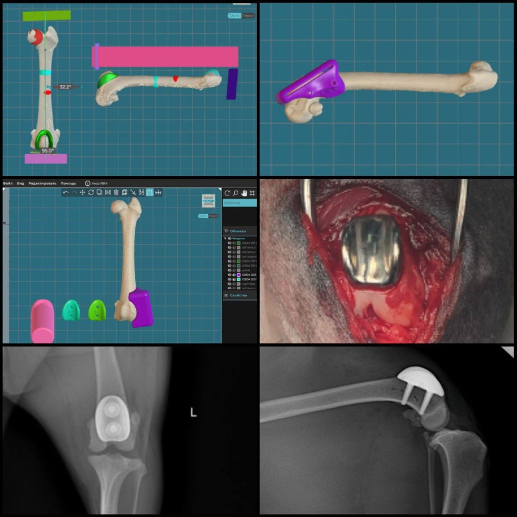 Patellar Groove Replacement